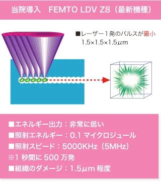 最新機種 FEMTO LDV Z8の性能表示