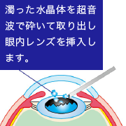 hakunai_img_4