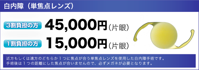 白内障（単焦点レンズ）の価格