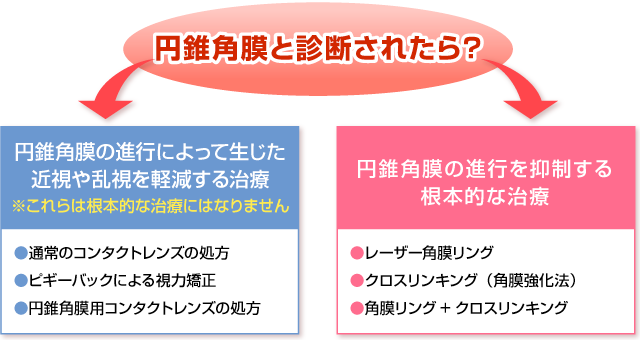 円錐角膜と診断されたら