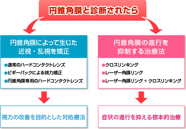 円錐角膜と診断されたら