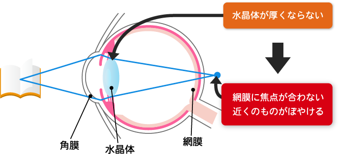 老眼の仕組み