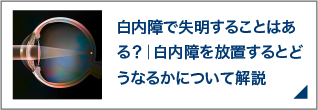 白内障で失明することはある？｜白内障を放置するとどうなるかについて解説