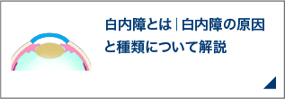 白内障とは｜白内障の原因と種類について解説