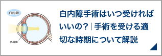 白内障手術はいつ受ければいいの？｜手術を受ける適切な時期について解説